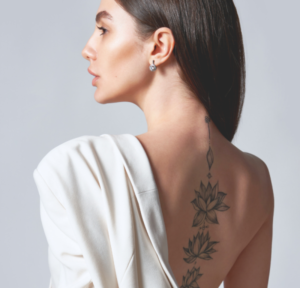 Eliminación de tatuajes